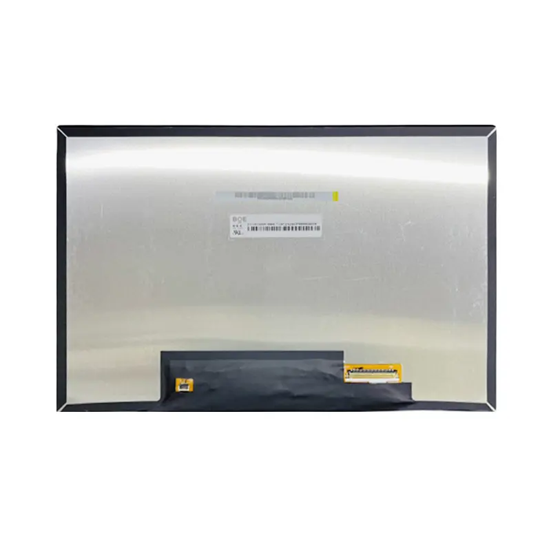 IPS Display 10.1 inch